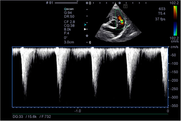 FIGURE 2