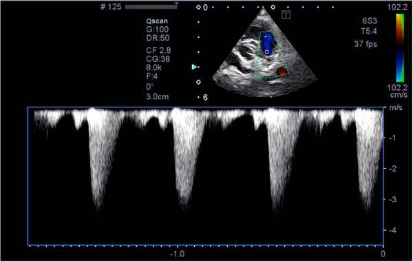 FIGURE 3