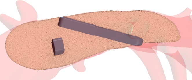 FIGURE 3