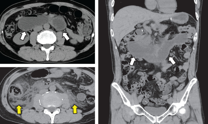 Fig. 1
