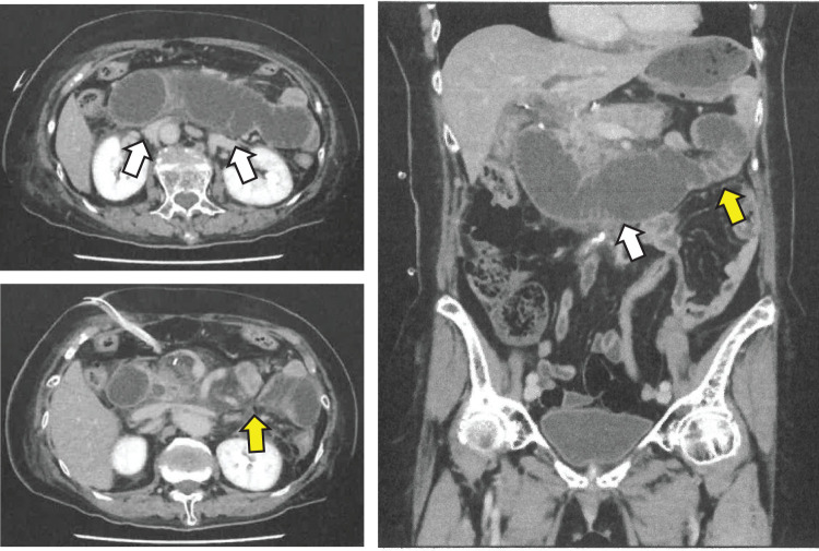 Fig. 3