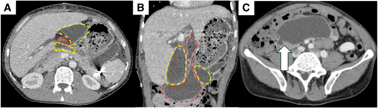 Fig. 2