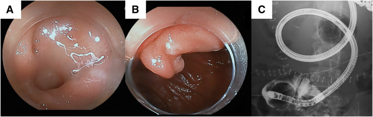 Fig. 3