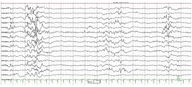 Fig. 4