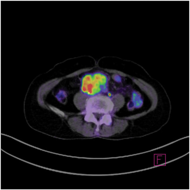 Fig. 3