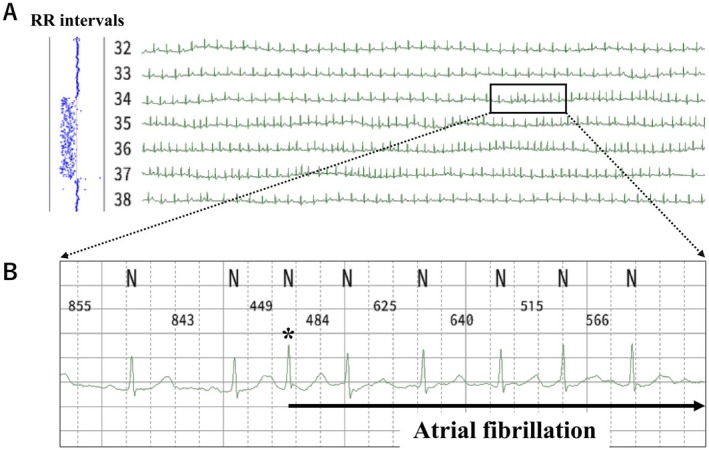 FIGURE 3