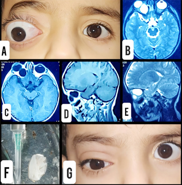 Fig.1