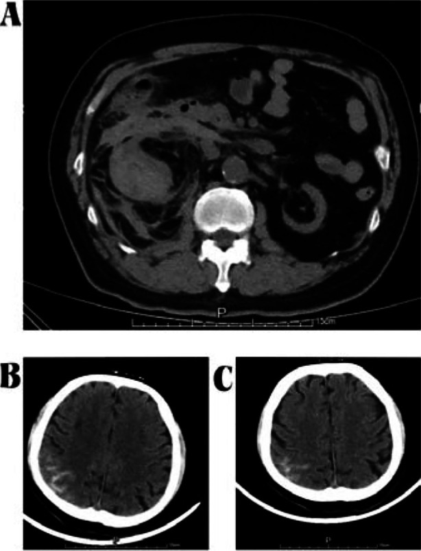 Fig.1