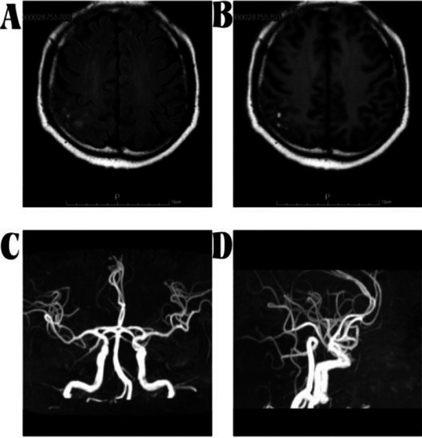 Fig.2
