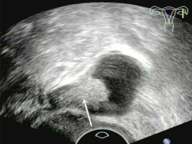 Fig.1
