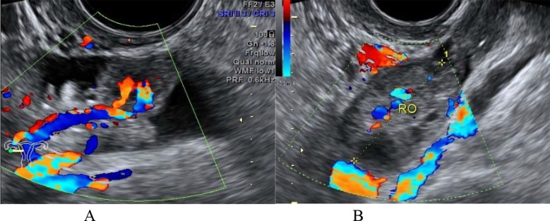 Fig.2