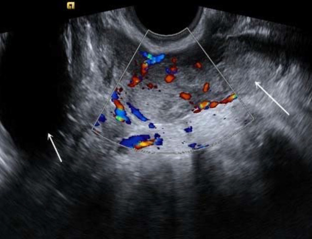 Fig.3