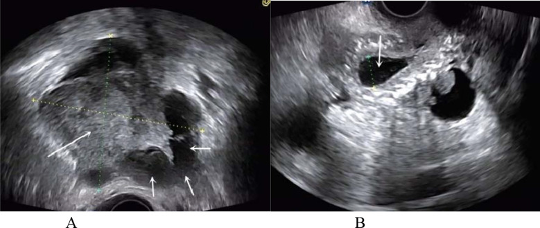 Fig.4