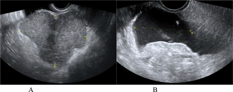Fig.5