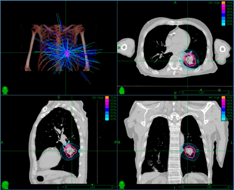 Figure 4