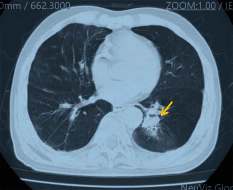 Figure 7