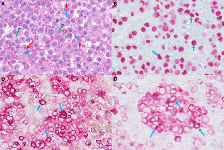 Figure 4