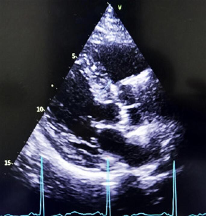 Figure 9