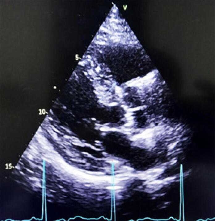 Figure 10