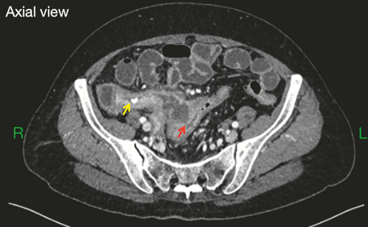Fig. 1