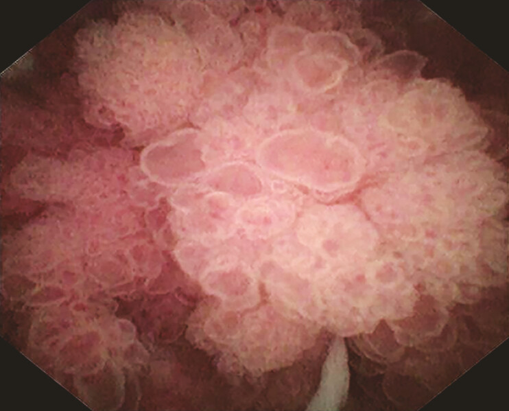 Fig. 2