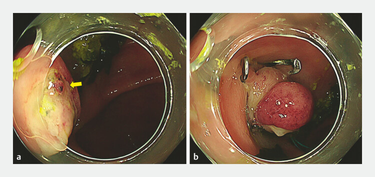 Fig. 3