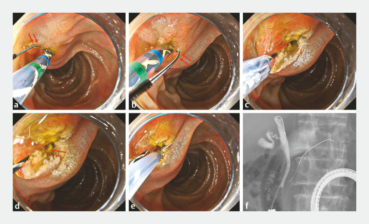 Fig. 4