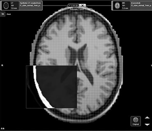 Figure 1