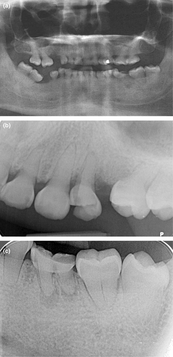 FIGURE 2