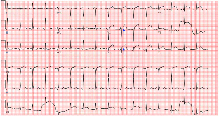 Figure 5