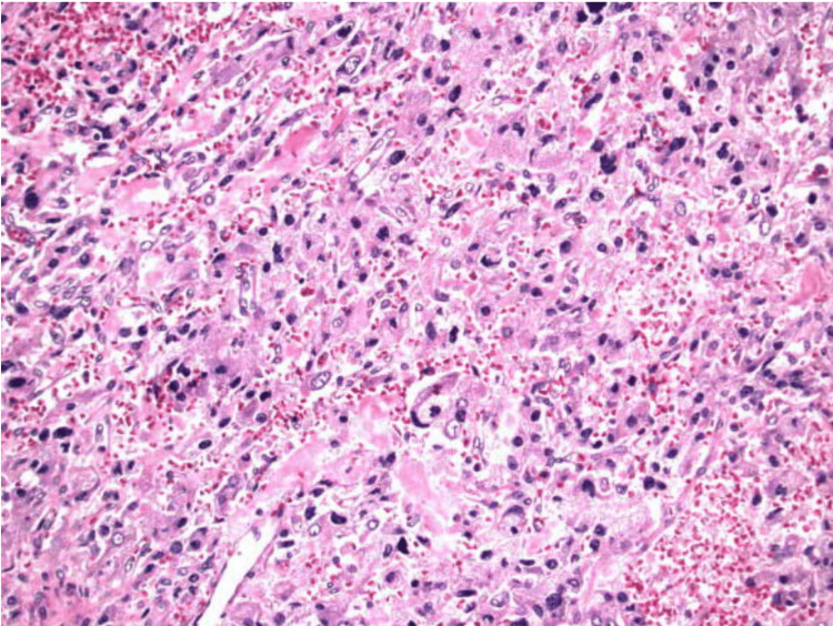 Figure 12