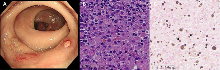Figure 2