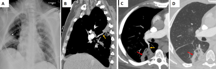 Figure 12