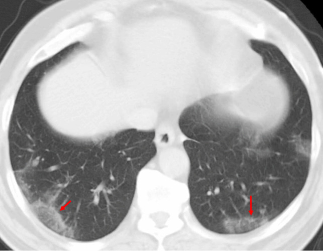 Figure 16