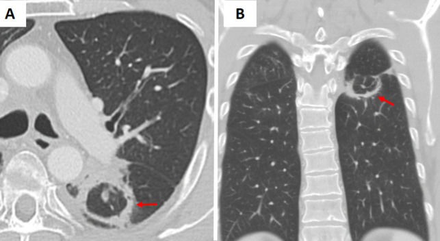 Figure 17