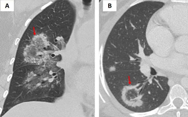 Figure 18