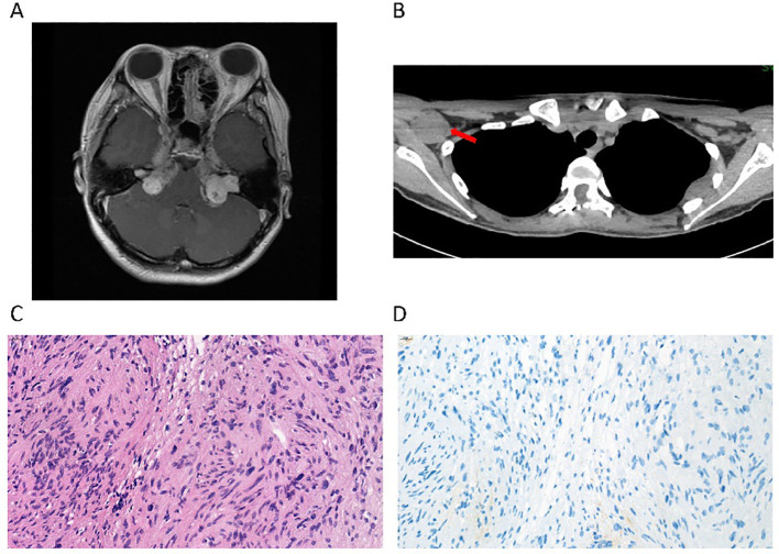 Figure 1