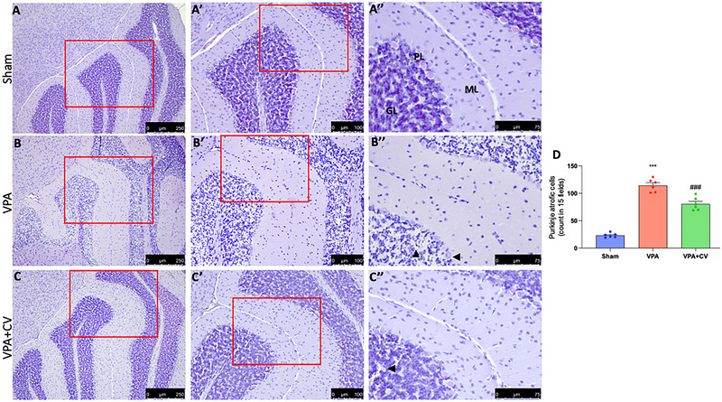 FIGURE 3