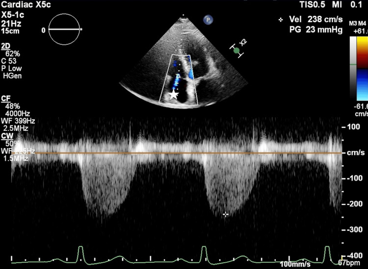 Figure 4