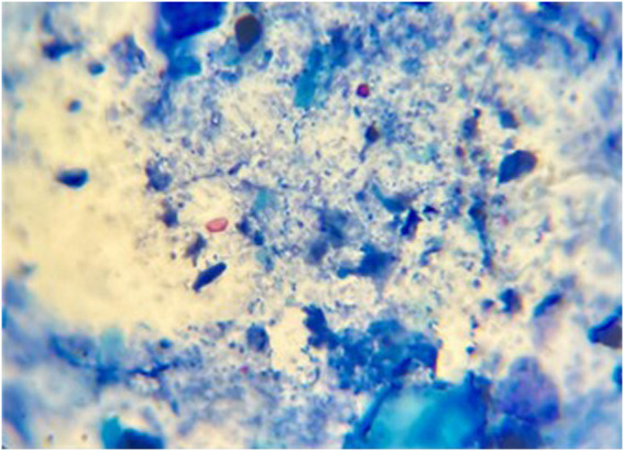 FIGURE 2