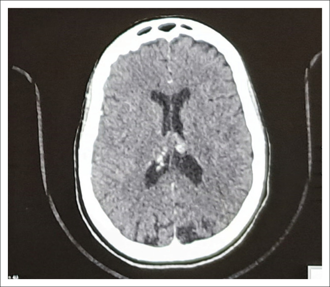 FIGURE 2