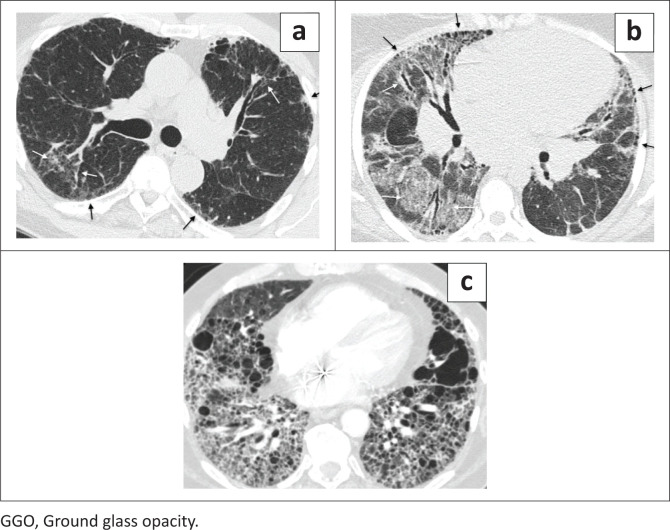 FIGURE 4