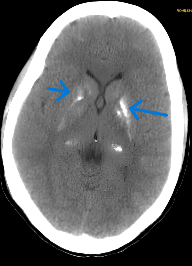 Figure 5