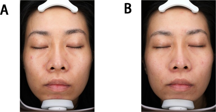 FIGURE 4