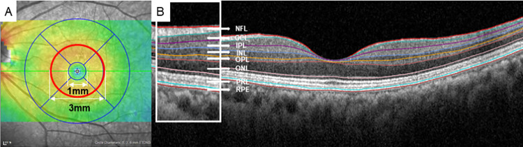Fig 1