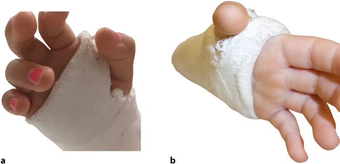 Figure 17