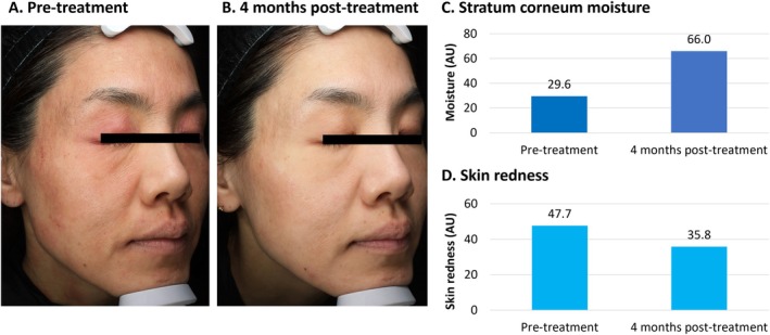 FIGURE 1