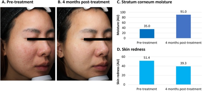 FIGURE 2