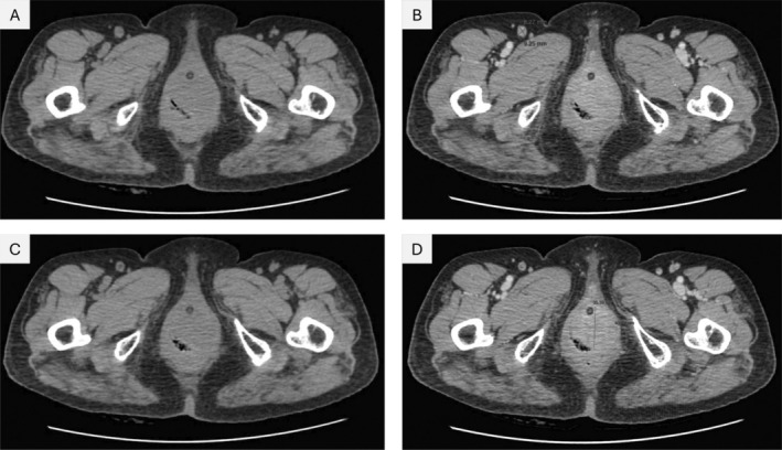 FIGURE 3