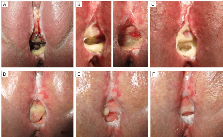 Figure 6
